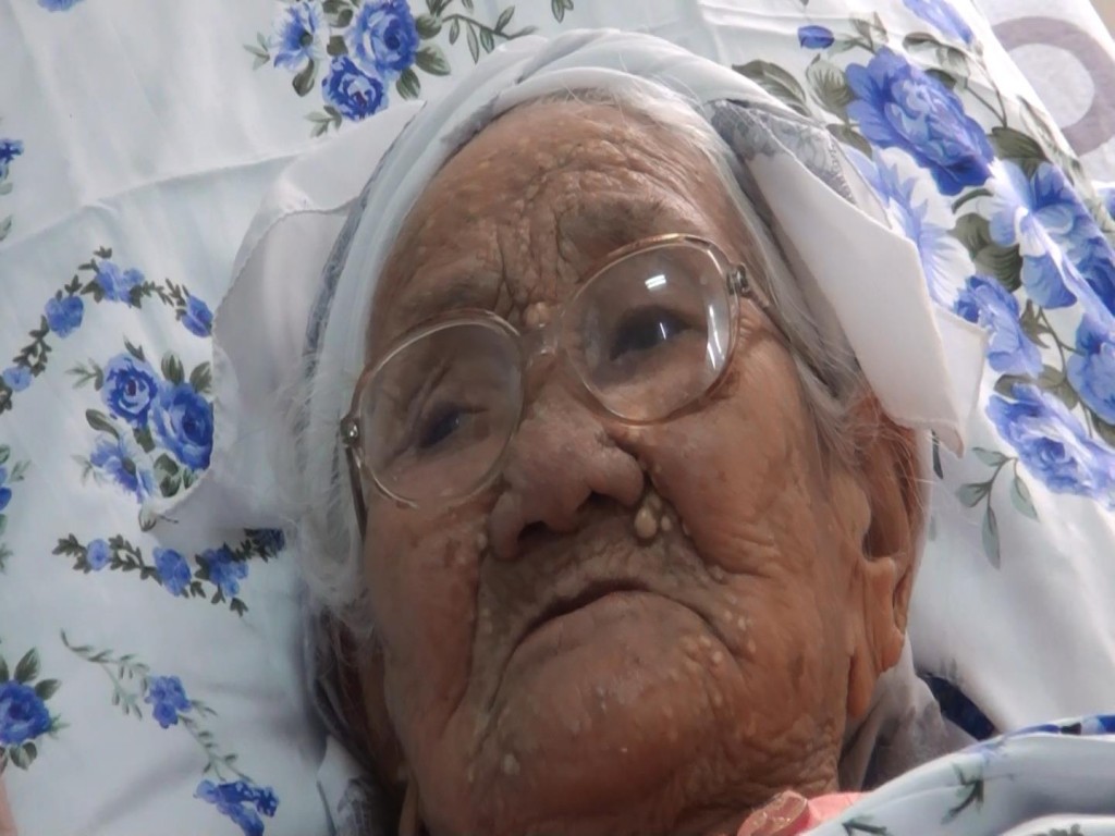 103-летнюю бабушку спасли от инфаркта шымкенские кардиохрурги