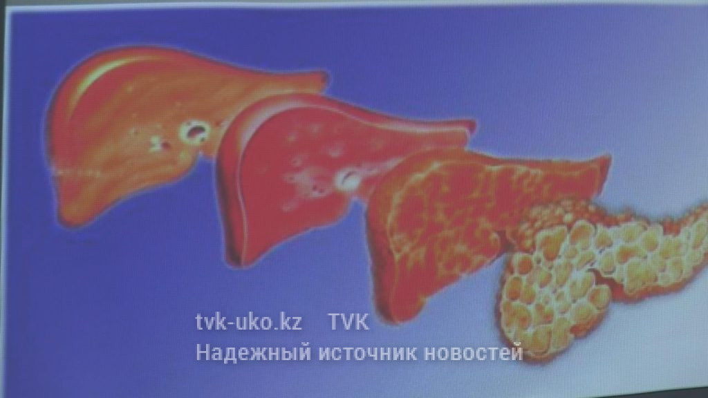 6 тысяч больных гепатитом зарегистрировано в ЮКО